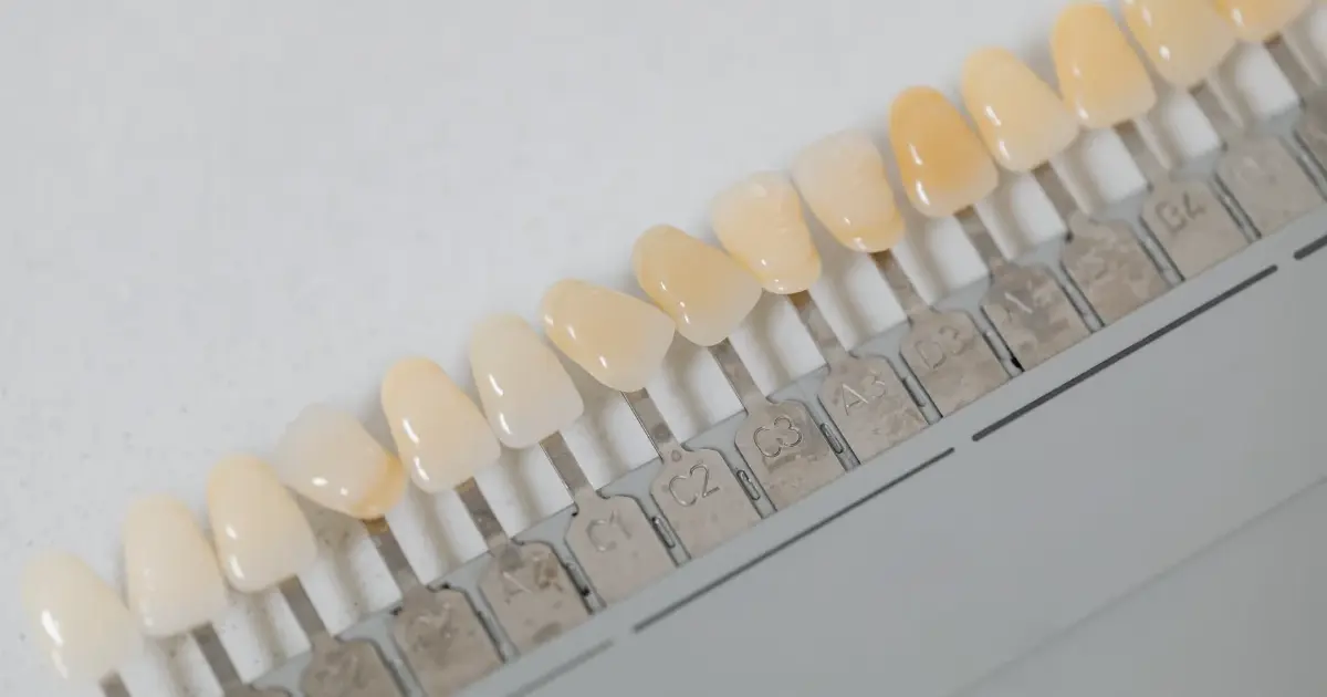 Carillas, coronas o implantes: en qué se diferencian y cuándo va cada uno | Odontología Mayer