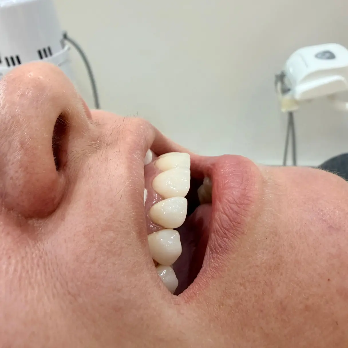 Diseño de sonrisa: planificar antes de tocar | Odontología Mayer